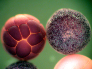Illustration for article titled Remarkable Nikon Small World Microscope Photography Winners